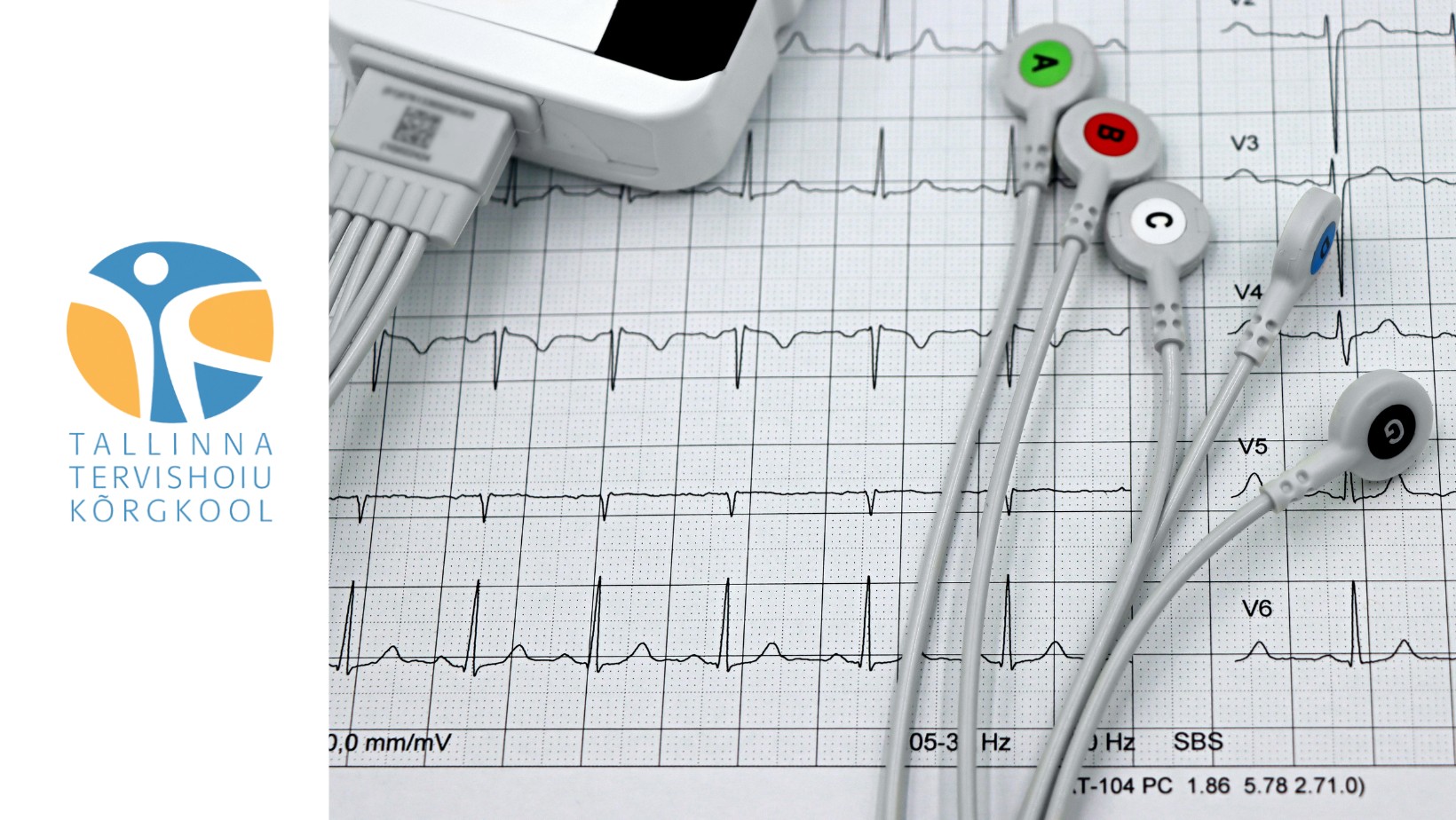 EKG alused ja tulemuste tõlgendamine